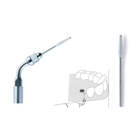 Ρίνες Ενδοδοντίας DT-069A