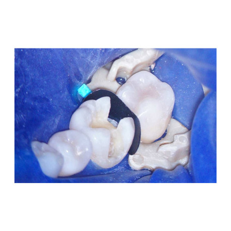 Τεχνητά Τοιχώματα LumiContrast