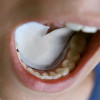 DryDent Sublingual